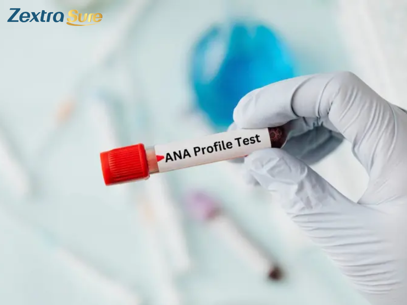 what-types-of-cancer-cause-positive-ana (2)